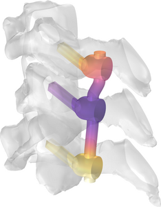 植入物在 MRI 中的射频发热