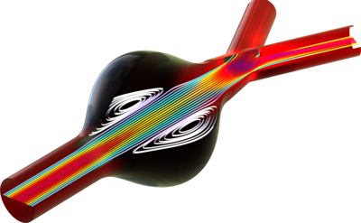 腹主动脉瘤中的血液流动