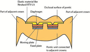 Design of a Pressure Sensor ...