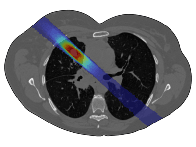 Hadron Therapy Simulation ...