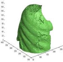 Deformable Image ...