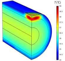 A Model of Noninvasive ...