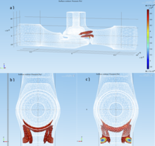3D Analysis of Cavitation ...