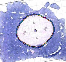 Finite Element Analysis of ...