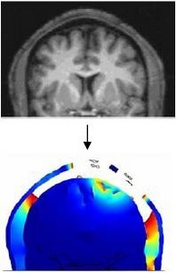 Electrical Stimulation of ...