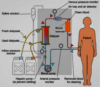 Design of Blood Warmer ...