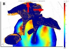 A Biological Gear in the ...