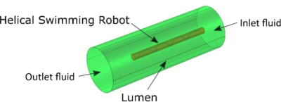 Finite element model of a ...