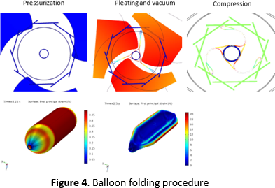FE-Simulation of PTCA ...
