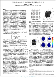 用于颅内出血检测的磁感应层析成像技术